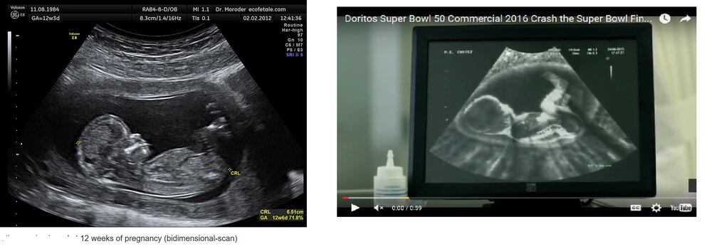 super bowl.jpg