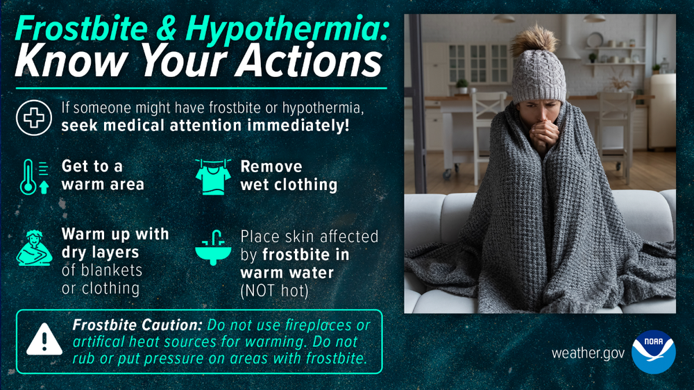 frostbite-hypothermia.thumb.png.aa2e6f15a6ee7a3365c67b3036b75d94.png